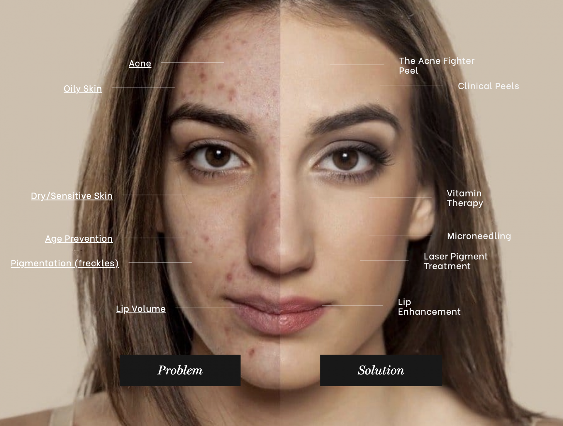Skin Concern Analysis - Before and After Treatment Comparison